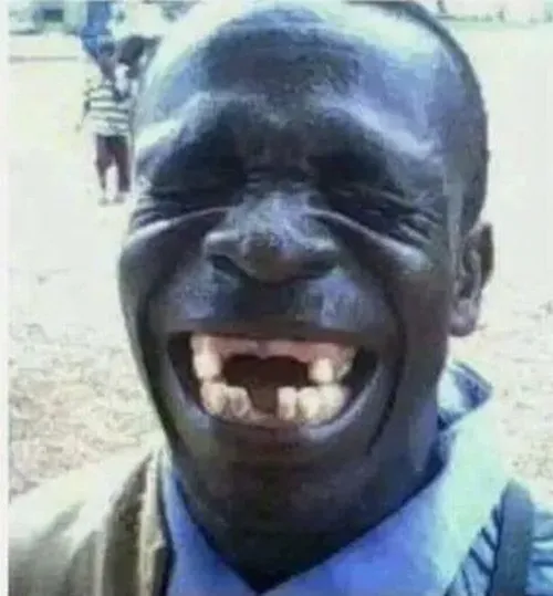 Hình troll khoảnh khắc bật cười với mặt gồm mắt miệng má hòa hợp